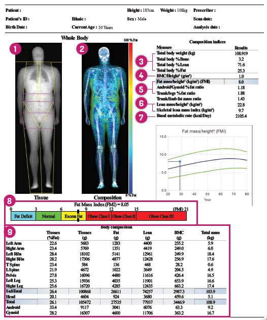 DEXA Scan - Scores & Everything You Need to Know