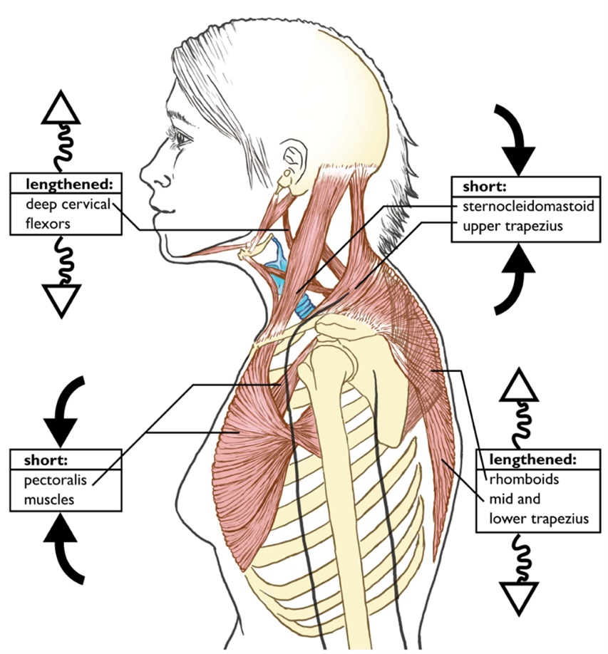 The Deep Neck Flexors Ally van Dorp AEP Vision Health